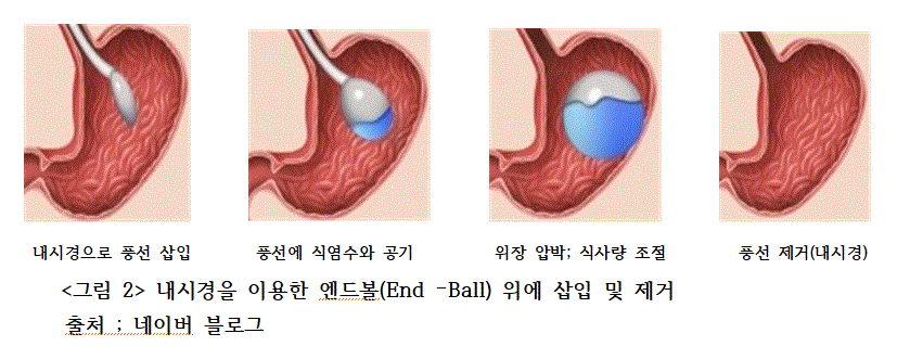 556cdae7976cdf2674a7e530c6cef808_1717205